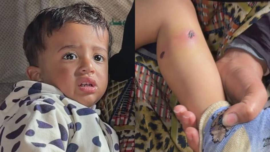 Ғазода 1,5 ёшли бола оёғига сигарет босилиб, қийноққа солинди — ОАВ